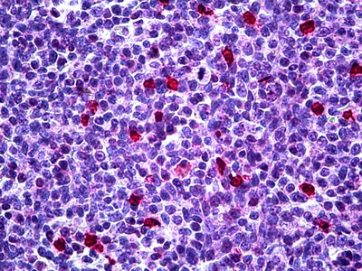 p27 Kip1 Antibody