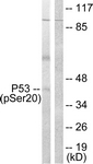 p53 (Phospho-Ser20) antibody