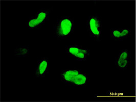 MAK Antibody (monoclonal) (M01)