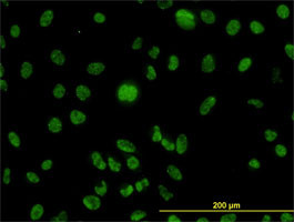 MLH1 Antibody (monoclonal) (M02)