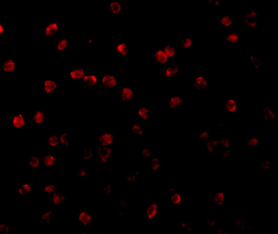 RPS6K1 Antibody