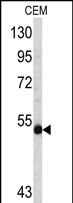 n-Myc antibody, C-term