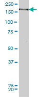 MYPN Antibody (monoclonal) (M04)