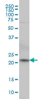 NKIRAS2 Antibody (monoclonal) (M02)