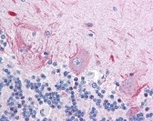Ribosomal Protein S6 Kinase Antibody