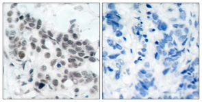 Retinoblastoma (Phospho-Ser780) antibody