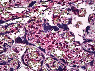 SMAD3 Antibody