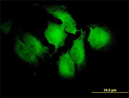 NOTCH2NL Antibody (monoclonal) (M01)