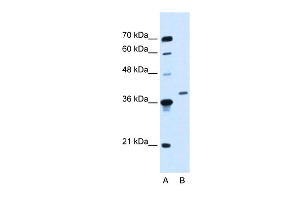 HOXD11 antibody - middle region