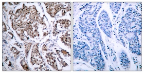 BAD (Phospho-Ser155) antibody
