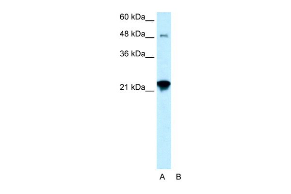 LASS2 antibody - N-terminal region