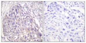 FOXO1/3/4-pan (Phospho-Thr24/32) antibody