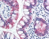 KRT18 Antibody