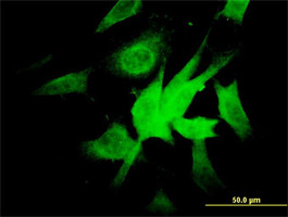 NDUFA9 Antibody (monoclonal) (M01)