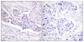 FOXO1A (Phospho-Ser329) antibody