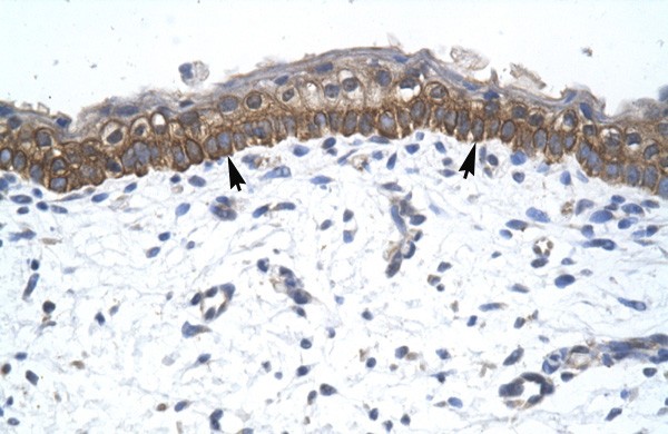 ZNF385 antibody - C-terminal region