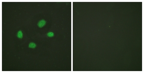 Chk2 (Phospho-Thr383) antibody