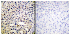 Vimentin (Phospho-Ser56) antibody
