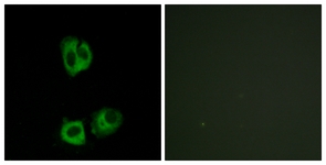Lck (Phospho-Tyr393) antibody