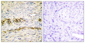 Akt (Phospho-Tyr474) antibody