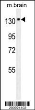 NTRK1 Antibody