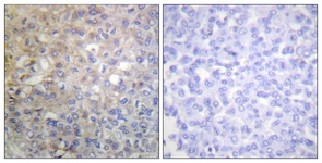 FGFR1 antibody