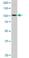 NAGLU Antibody (monoclonal) (M02)