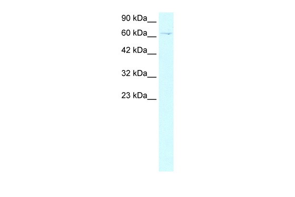 ZBTB20 antibody - middle region