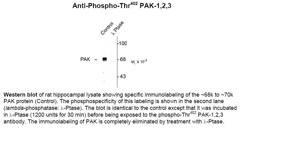 PAK1 (phospho Thr402) Antibody