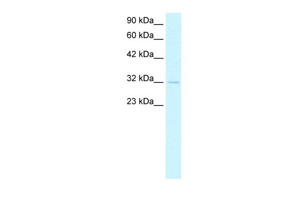 CSEN antibody - N-terminal region