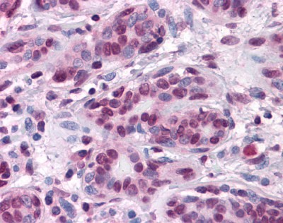 Beta Catenin Antibody