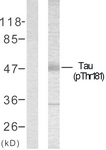 Tau (Phospho-Thr181) antibody