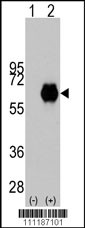 MYC Antibody (T358)