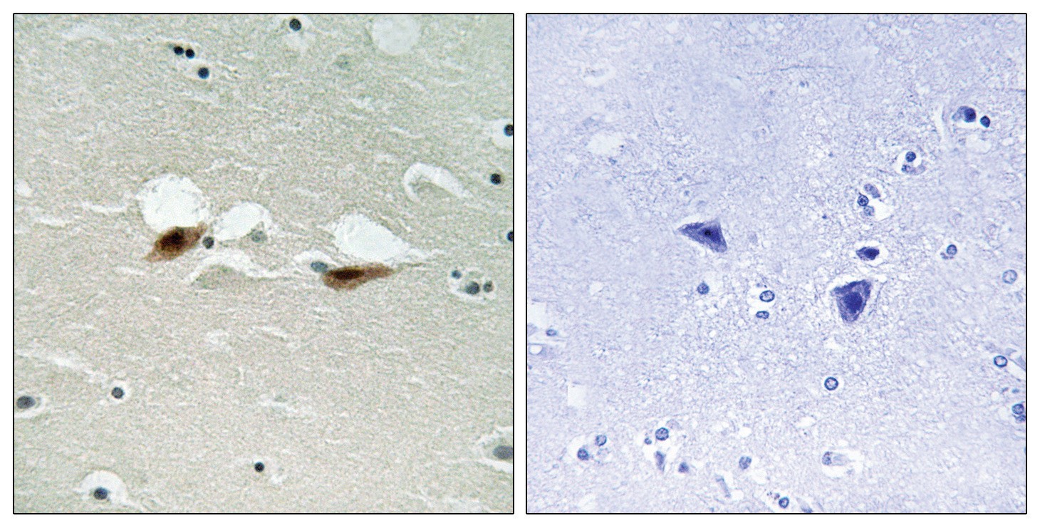 ATF-2 (phospho Ser472) Antibody