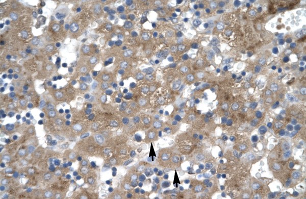 ZNF81 antibody - middle region