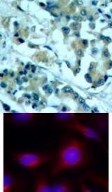 MEK1 / MEK2 Antibody
