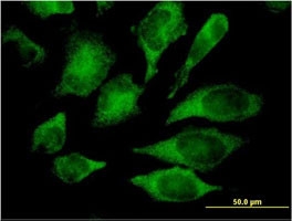 MAPK13 Antibody (monoclonal) (M03)