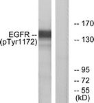 EGFR (Phospho-Tyr1172) antibody