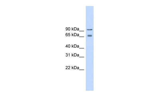 CACNB2antibody - middle region