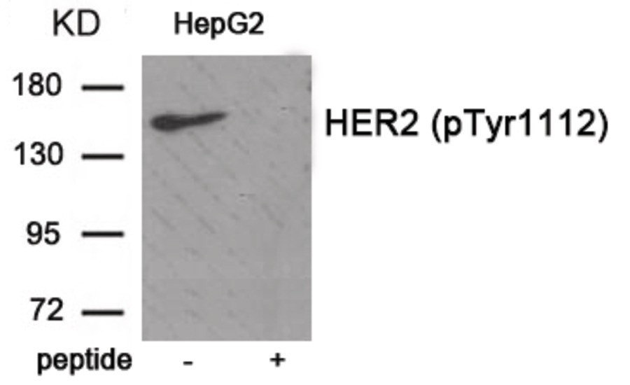 HER2 (phospho Tyr1112) Antibody