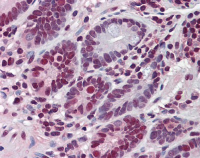 HDAC1 Antibody