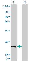 MYL5 Antibody (monoclonal) (M01)