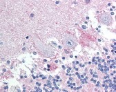 BAD Antibody