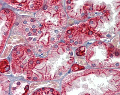 Cytoke Antibody