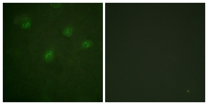 Estrogen Receptor-alpha antibody