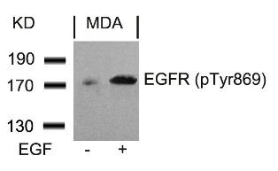 EGFR (phospho Tyr869) Antibody