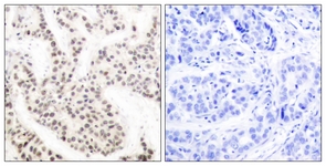 Elk1 (Phospho-Thr417) antibody