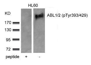 ABL1 / 2 (phospho Tyr393 / Tyr429) Antibody