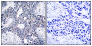 ZAP-70 antibody