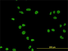 MCM7 Antibody (monoclonal) (M01)